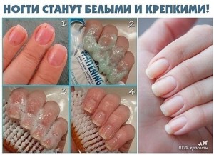 image (1)